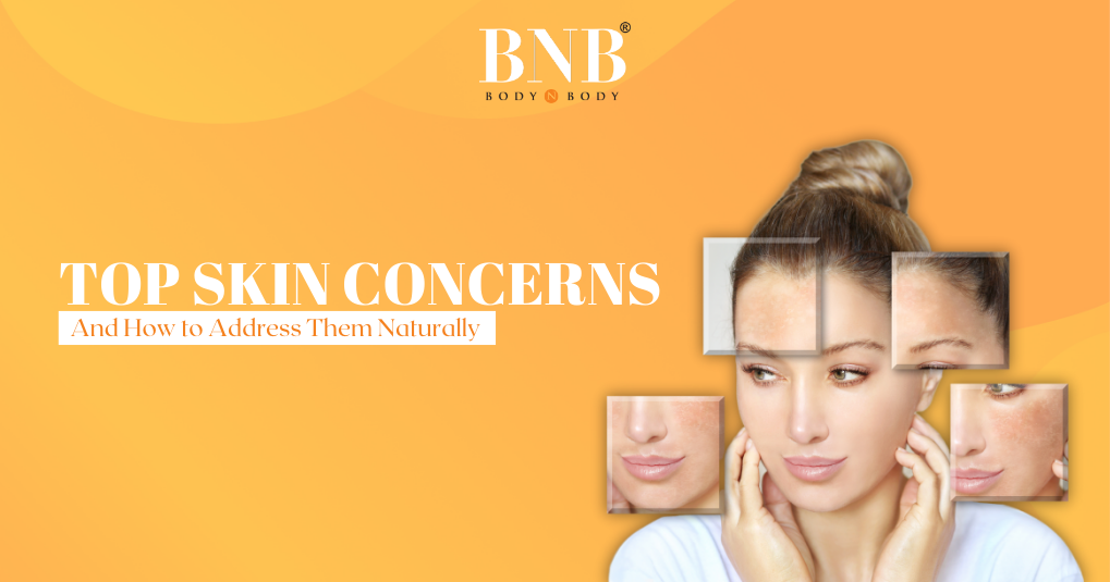 Top Skin Concerns and How to Address Them Naturally